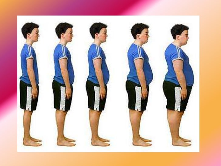 Anorexia and obesity
Obese Vs Anorexic