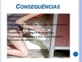 Consequências  	Depressão;  	Fadiga;	Irregularidade menstrual (no caso das mulheres);	Arritmia Cardíaca;	Problemas de esófago e de estômago;	Fragilidade dos dentes e dos ossos (devido à conclusão do vómito).
