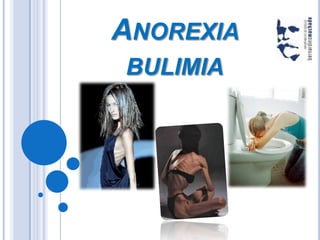 Anorexia  bulimia 