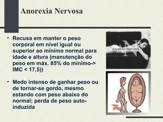 Anorexia Nervosa Recusa em manter o peso corporal em nível igual ou superior ao mínimo normal para idade e altura (manutenção do peso em máx. 85% do mínimo-> IMC < 17,5)) Medo intenso de ganhar peso ou de tornar-se gordo, mesmo estando com peso abaixo do normal; perda de peso auto-induzida 