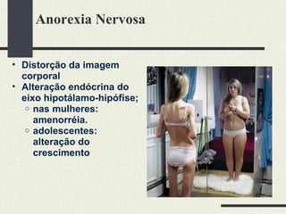 Anorexia Nervosa Distorção da imagem corporal Alteração endócrina do eixo hipotálamo-hipófise;  nas mulheres: amenorréia. adolescentes: alteração do crescimento 