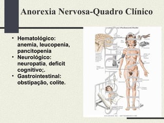 Anorexia Nervosa-Quadro Clínico Hematológico: anemia, leucopenia, pancitopenia  Neurológico: neuropatia ,  deficit  cognitivo;. Gastrointestinal: obstipação, colite.  