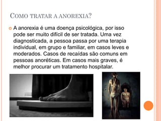 COMO TRATAR A ANOREXIA?
 A anorexia é uma doença psicológica, por isso
pode ser muito difícil de ser tratada. Uma vez
diagnosticada, a pessoa passa por uma terapia
individual, em grupo e familiar, em casos leves e
moderados. Casos de recaídas são comuns em
pessoas anoréticas. Em casos mais graves, é
melhor procurar um tratamento hospitalar.
 