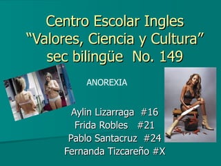 Centro Escolar Ingles “Valores, Ciencia y Cultura” sec bilingüe  No. 149 Aylin Lizarraga  #16 Frida Robles  #21 Pablo Santacruz  #24 Fernanda Tizcareño #X ANOREXIA 