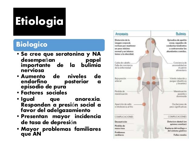 Imagen relacionada