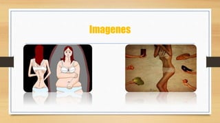 Imagenes
 