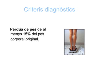 Criteris diagnòstics


Pèrdua de pes de al
menys 15% del pes
corporal original.
 
