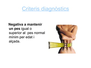 Criteris diagnòstics

Negativa a mantenir
un pes igual o
superior al pes normal
mínim per edat i
alçada.
 