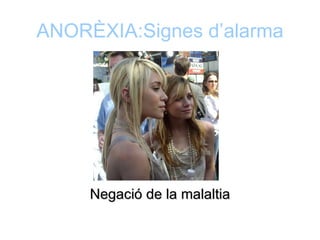 ANORÈXIA:Signes d’alarma




     Negació de la malaltia
 