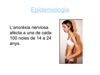 Epidemiologia

L’anorèxia nerviosa
afecta a una de cada
100 noies de 14 a 24
anys.
 