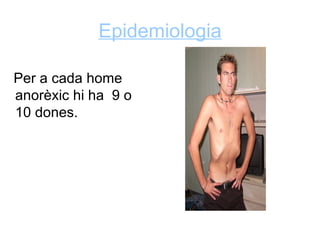 Epidemiologia

Per a cada home
anorèxic hi ha 9 o
10 dones.
 