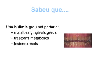 Sabeu que....

Una bulímia greu pot portar a:
  – malalties gingivals greus
  – trastorns metabòlics
  – lesions renals
 