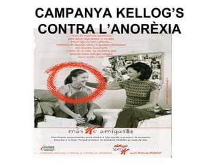 CAMPANYA KELLOG’S
CONTRA L’ANORÈXIA
 