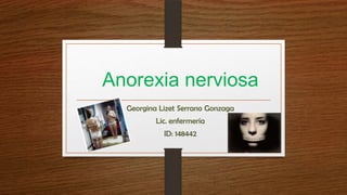 Anorexia nerviosa
Georgina Lizet Serrano Gonzaga
Lic. enfermería
ID: 148442
 