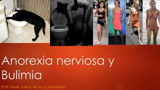 Anorexia nerviosa y
Bulimia
POR OMAR JORGE TRUJILLO ANGUIANO
 