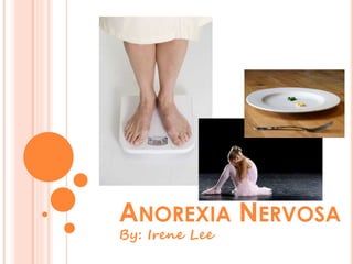 ANOREXIA NERVOSA
By: Irene Lee
 