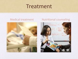 Treatment
Medical treatment Nutritional counseling
 