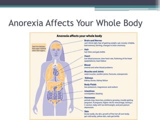 Anorexia nervosa | PPTX