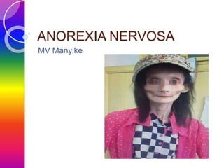 ANOREXIA NERVOSA
MV Manyike
 