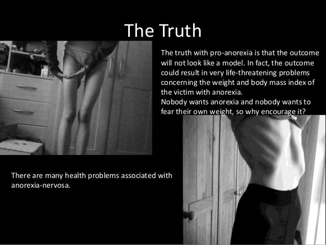 an introduction to the anorexia nervosa and the issue of the abnormal weight loss Eating disorders online medical reference - covering definition through treatment authored by kathleen n franco of the cleveland clinic eating disorders are syndromes characterized by severe disturbances in eating behavior and by distress or excessive concern about body shape or weight. an introduction to the anorexia nervosa and the issue of the abnormal weight loss Eating disorders online medical reference - covering definition through treatment authored by kathleen n franco of the cleveland clinic eating disorders are syndromes characterized by severe disturbances in eating behavior and by distress or excessive concern about body shape or weight.