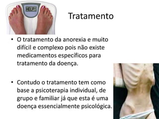 TratamentoO tratamento da anorexia e muito difícil e complexo pois não existe medicamentos específicos para tratamento da doença.Contudo o tratamento tem como base a psicoterapia individual, de grupo e familiar já que esta é uma doença essencialmente psicológica.
