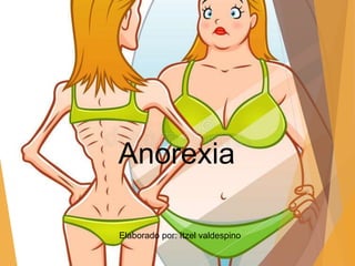 Anorexia
Elaborado por: Itzel valdespino
 