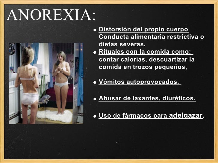 Anorexia dietas para adelgazar