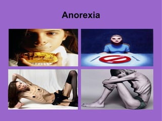 Anorexia 