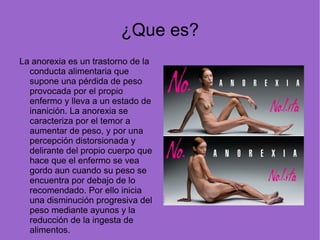 ¿Que es? La anorexia es un trastorno de la conducta alimentaria que supone una pérdida de peso provocada por el propio enfermo y lleva a un estado de inanición. La anorexia se caracteriza por el temor a aumentar de peso, y por una percepción distorsionada y delirante del propio cuerpo que hace que el enfermo se vea gordo aun cuando su peso se encuentra por debajo de lo recomendado. Por ello inicia una disminución progresiva del peso mediante ayunos y la reducción de la ingesta de alimentos. 