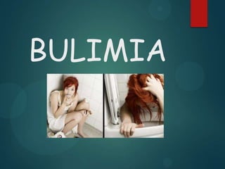 BULIMIA

 