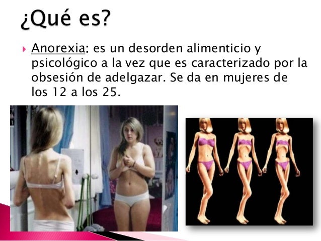 QUE ES ANOREXIA PDF DOWNLOAD QUE ES ANOREXIA PDF DOWNLOAD