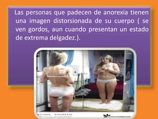 Las personas que padecen de anorexia tienen
una imagen distorsionada de su cuerpo ( se
ven gordos, aun cuando presentan un estado
de extrema delgadez.).
 