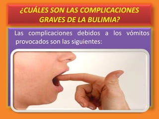 ¿CUÁLES SON LAS COMPLICACIONES
GRAVES DE LA BULIMIA?
Las complicaciones debidos a los vómitos
provocados son las siguientes:
 