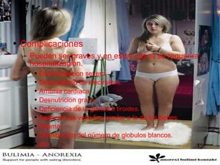 . Complicaciones Pueden ser graves y en estos casos se requerira hospitalización. Deshidratacion severa. Desequilibrio de electrolitos. Arritmia cardíaca. Desnutricion grave. Deficiencia de la glándula tiroides. Aparicion de vello fino similar a la de los bebes. Edema. Disminución del número de globulos blancos. etc. 