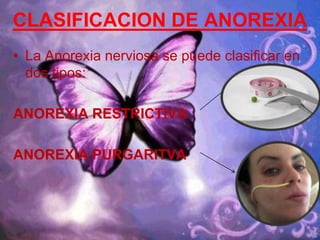 ¿QuÈ eS lA aNoReXiA?Trastorno alimenticio que consiste en una obsesión por estar delgada y no engordar, el  cual se caracteriza por un adelgazamiento rápido y por lo tanto alarmante. Este adelgazamiento se consigue primero reduciendo y después suprimiendo el consumo de alimentos y también recurriendo a laxantes, diuréticos, productos dieteticos, etc.