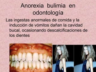 ¿CòMo PrEvEnIrLo?*Tener una buena comunicación entre la familia.*Ir con un nutriologo para poder mantener un peso adecuado sanamente.*Hacer ejercicio moderado *No dejarse guiar por los estereotipos de los medios de comunicación.