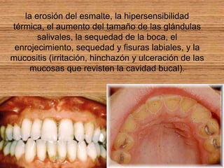 Anorexia  bulimia  en odontología Las ingestas anormales de comida y la inducción de vómitos dañan la cavidad bucal, ocasionando descalcificaciones de los dientes