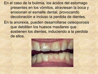 Estas manifestaciones son reconocibles para el odontólogo y le avisan de que algún trastorno alimenticio esta afectando a su paciente.La relevancia de nuestro papel para su diagnostico radica en que estas lesiones en la cavidad bucal pueden ser irreversibles