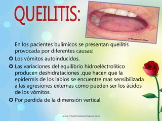Sensibilidad dental a estímulos térmicos, 