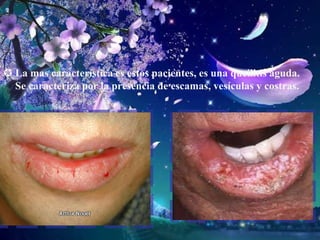 Alteraciones en la mucosa bucal y tejidos periodontales.