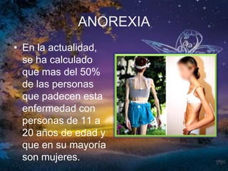 El término anorexia proviene del griego a-/an- (negación) + orégo (tender, apetecer). Es un síntoma frecuente en multitud de enfermedades y situaciones fisiológicas consistente en la disminución del apetito, lo que puede conducir a una disminución de la ingesta de alimentos.