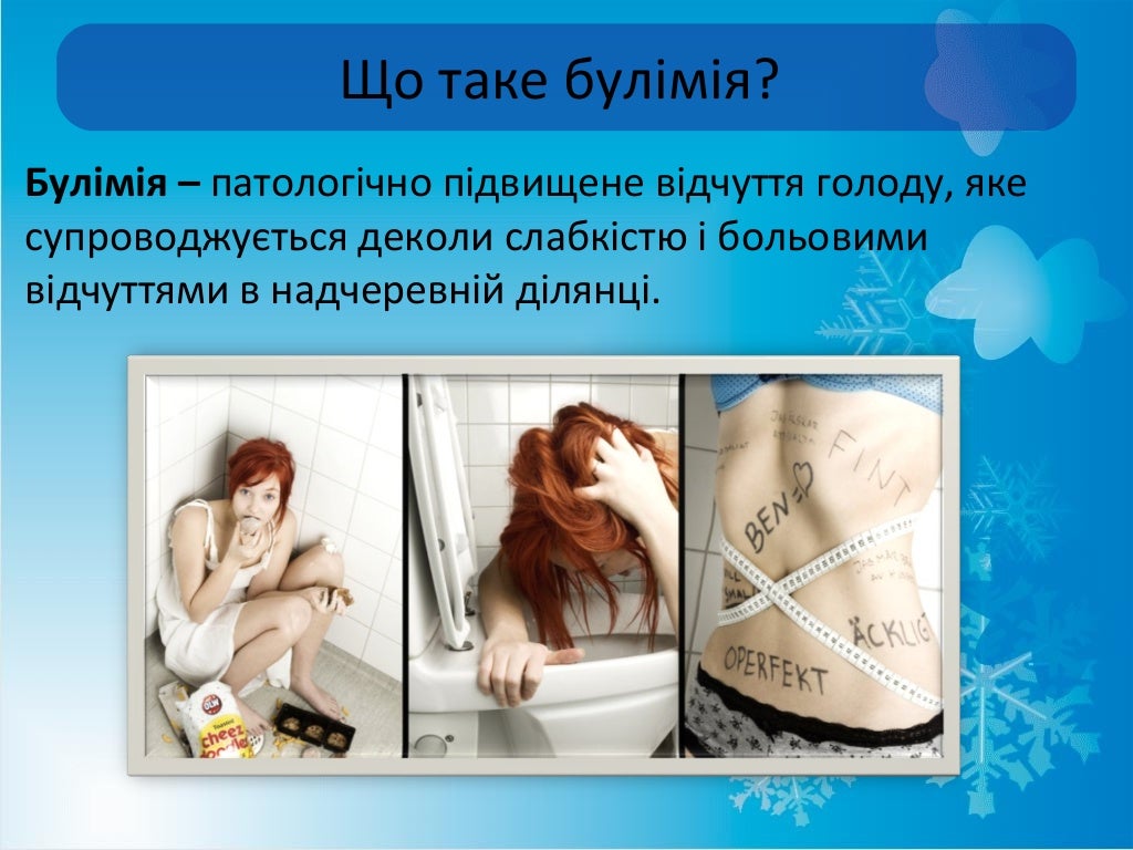 Анорексія