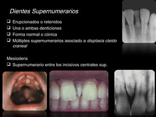 Dientes Supernumerarios 
 Erupcionados o retenidos 
 Una o ambas denticiones 
 Forma normal o cónica 
 Múltiples supernumerarios asociado a displasia cleido 
craneal 
Mesiodens 
 Supernumerario entre los incisivos centrales sup. 
 