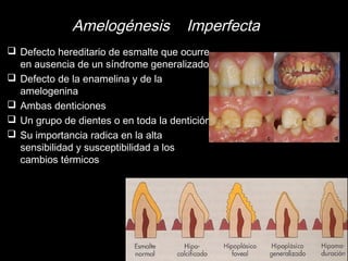 Amelogénesis Imperfecta 
 Defecto hereditario de esmalte que ocurre 
en ausencia de un síndrome generalizado 
 Defecto de la enamelina y de la 
amelogenina 
 Ambas denticiones 
 Un grupo de dientes o en toda la dentición 
 Su importancia radica en la alta 
sensibilidad y susceptibilidad a los 
cambios térmicos 
 