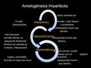 Amelogénesis Imperfecta 
zonas ausentes de 
Foveal esmalte, color blanco 
Generalizado o amarillento 
radiopacidad mayor que 
dentina 
más frecuente 
esmalte blando, se radiopacidad menor que 
desprende fácilmente dentina 
Dientes con pérdida de 
contacto interproximal 
espesor normal , puede 
retirarse con un aspecto 
rugoso, permeable instrumento 
Esmalte en copos de nieve radiopacidad menor 
que dentina 
 