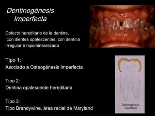 Dentinogénesis 
Imperfecta 
Defecto hereditario de la dentina, 
con dientes opalescentes, con dentina 
Irregular e hipomineralizada 
Tipo 1: 
Asociado a Osteogénesis Imperfecta 
Tipo 2: 
Dentina opalescente hereditaria 
Tipo 3: 
Tipo Brandywine, área racial de Maryland 
 