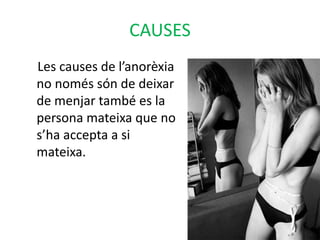 CAUSES    Les causes de l’anorèxia no només són de deixar de menjar també es la persona mateixa que no s’ha accepta a si mateixa. 