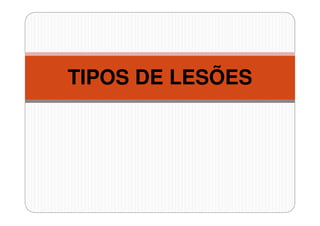 TIPOS DE LESÕES

 