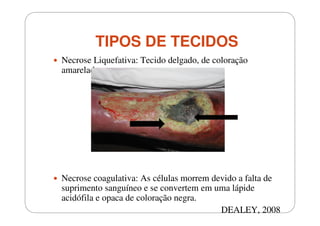 TIPOS DE TECIDOS
Necrose Liquefativa: Tecido delgado, de coloração
amarelada.

Necrose coagulativa: As células morrem devido a falta de
suprimento sanguíneo e se convertem em uma lápide
acidófila e opaca de coloração negra.
DEALEY, 2008

 