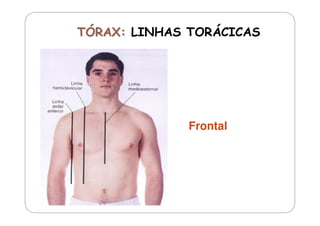 Frontal

 